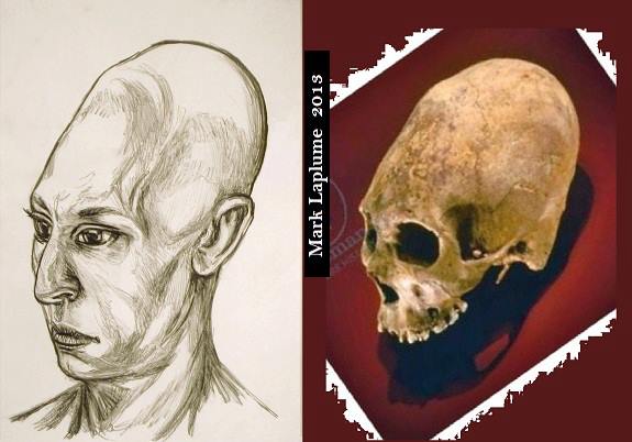 Enigma of the Worldwide Elongated Skull People
