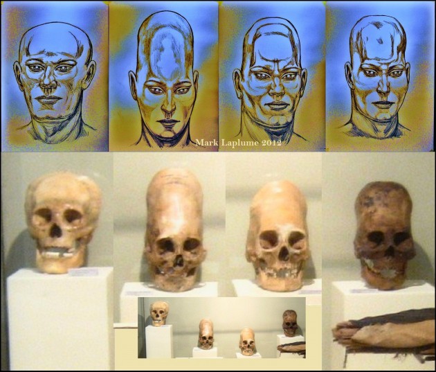 Enigma of the Worldwide Elongated Skull People