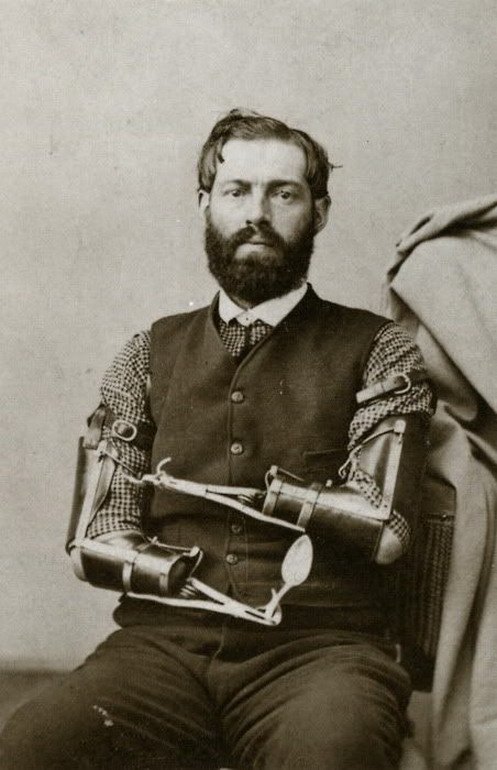 Civil War veteran Samuel Decker poses with the prosthetic arms he made for himself... somehow.