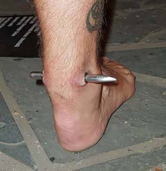 27 Most Extreme Body Modifications!
