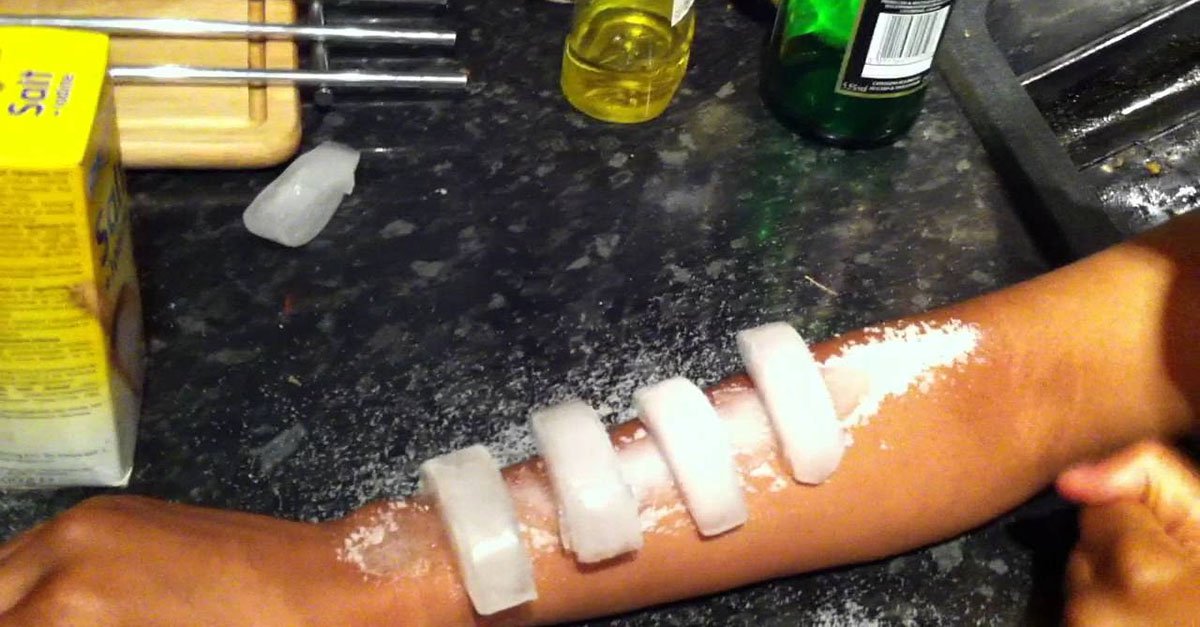 This one’s been around for five years, but it’s making a comeback that endangers anyone who partakes in it.

It's called the "salt and ice challenge," and YouTube videos of it date back to 2012.