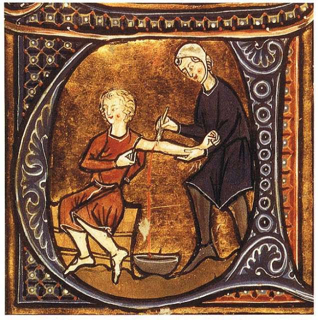 medieval medical treatment - O000000