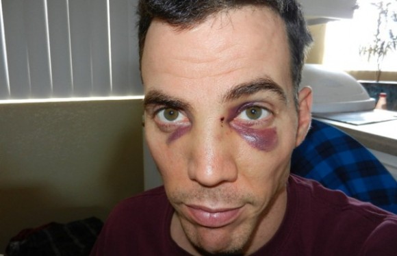 SteveO - English-Canadian-American stunt performer, comedian, and TV personality