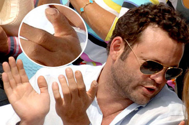 Vince Vaughn lost the tip of his right thumb in a car accident as a teenager