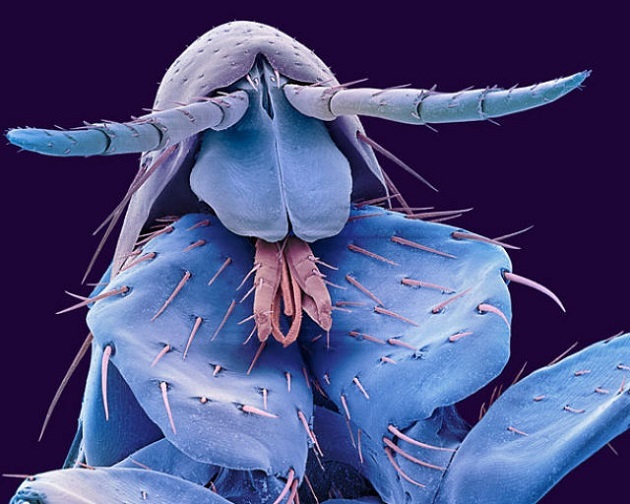 The head of a flea.
