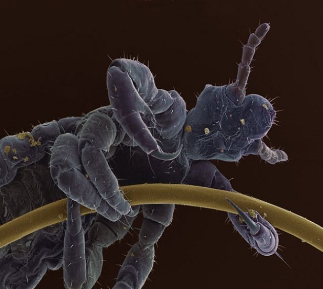 A human head louse clinging to a hair