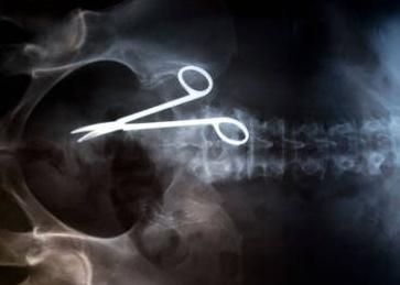 X-rays of Unusual Objects in the Human Body