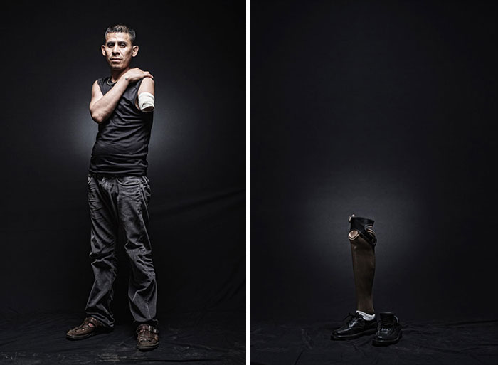 Armando, El Salvador. His destination was the United States, but he was deported in Baja, California while riding in a cargo train crossing Mexico. He retried the trip through Tenosique, Tabasco, where the train cut his limbs off.