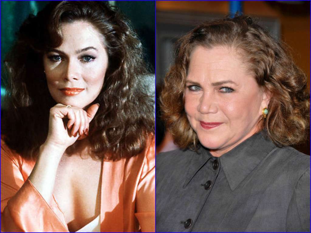 20 celebs not aging well
