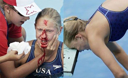 Horrible Sports Injuries