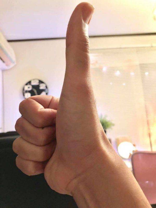 reddit long thumb