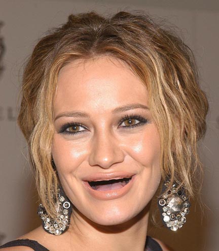 Actresses Without Teeth