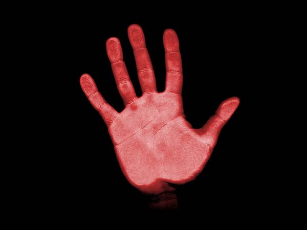 Alien Hand Syndrome: This is a neurological disorder where a persons hand appears to take on a mind of its own.