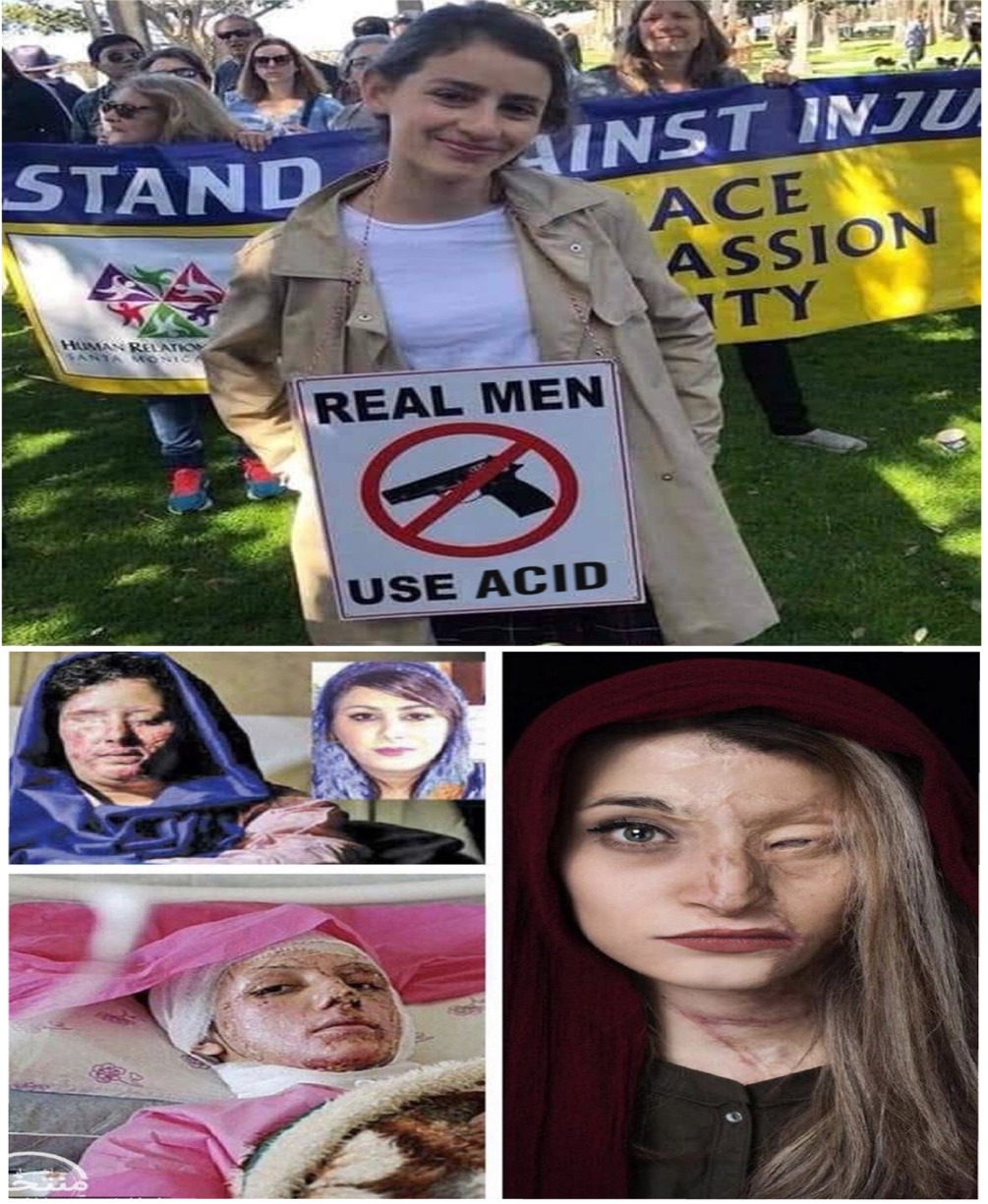 girl - Inst Inju Stand Ce Ssion Lity Real Men Use Acid