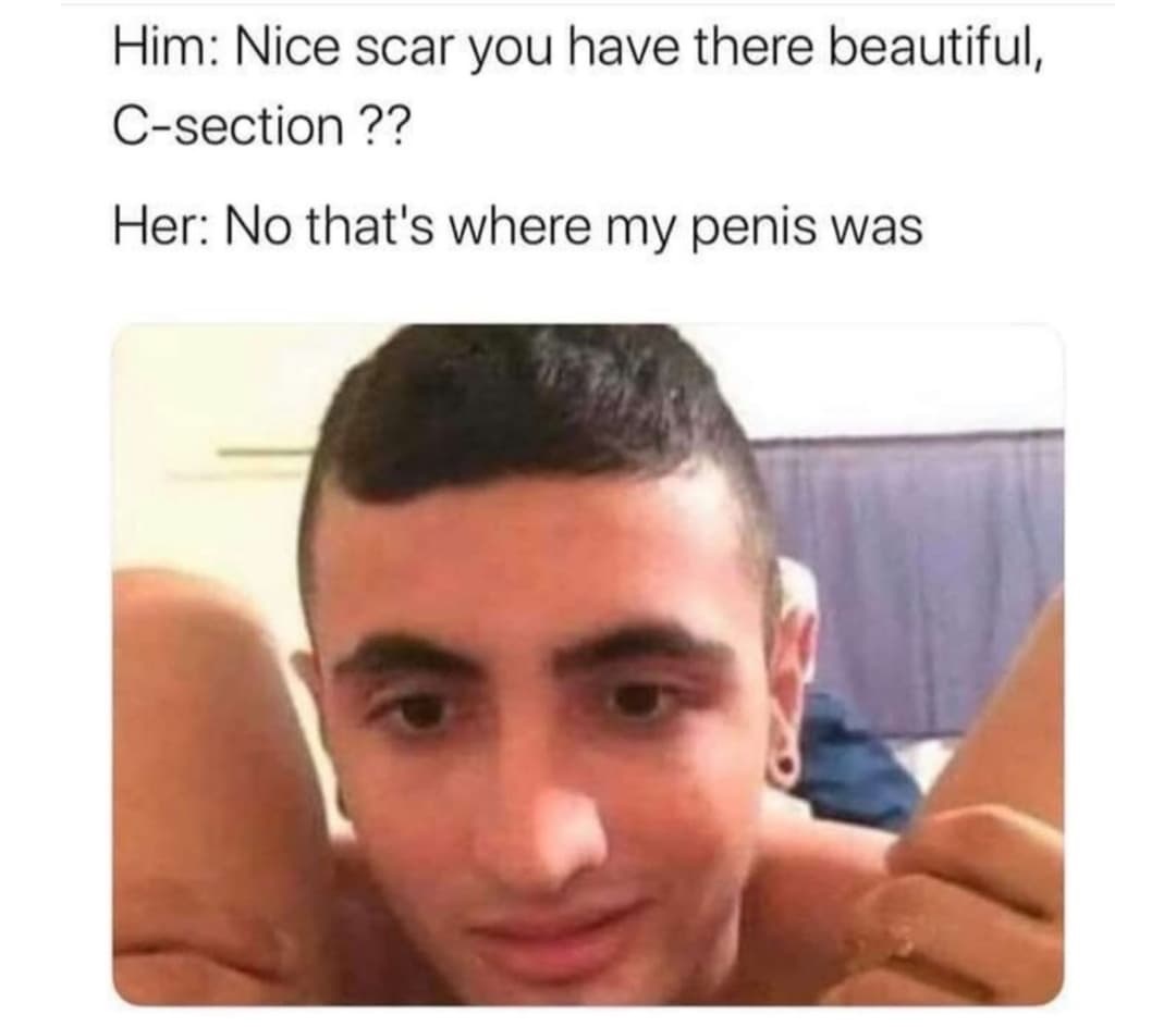 Him Nice scar you have there beautiful, Csection ?? Her No that's where my penis was