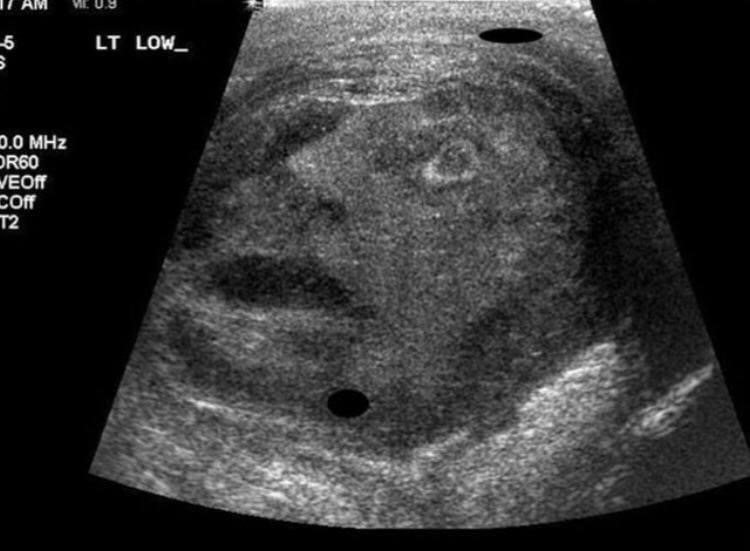 ultrasound testicle - Lt LOW_ 0.0 MHz R60 VEOff Coff T2