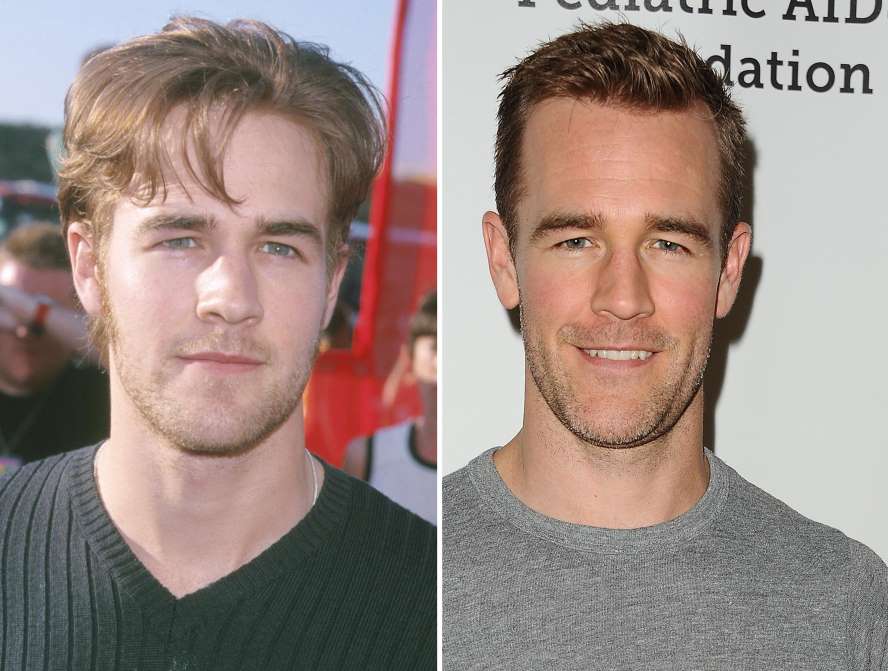 90's Actors Then and Now