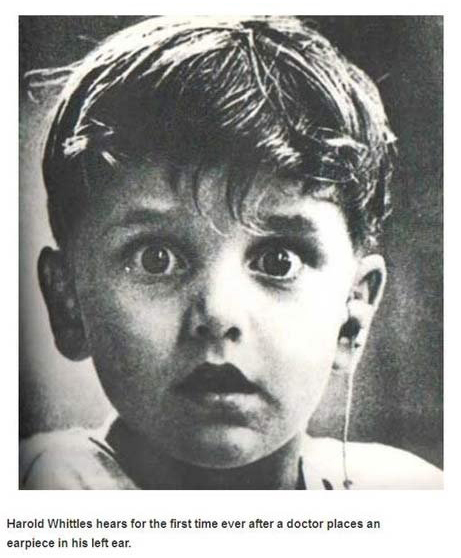 harold whittles - Harold Whitties hears for the first time ever after a doctor places an earpiece in his left ear.