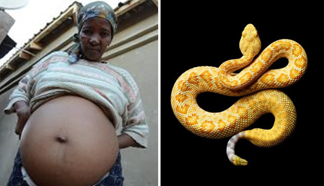 A woman in South Africa showed all the normal symptoms of being pregnant, but soon discovered there was a snake inside her
