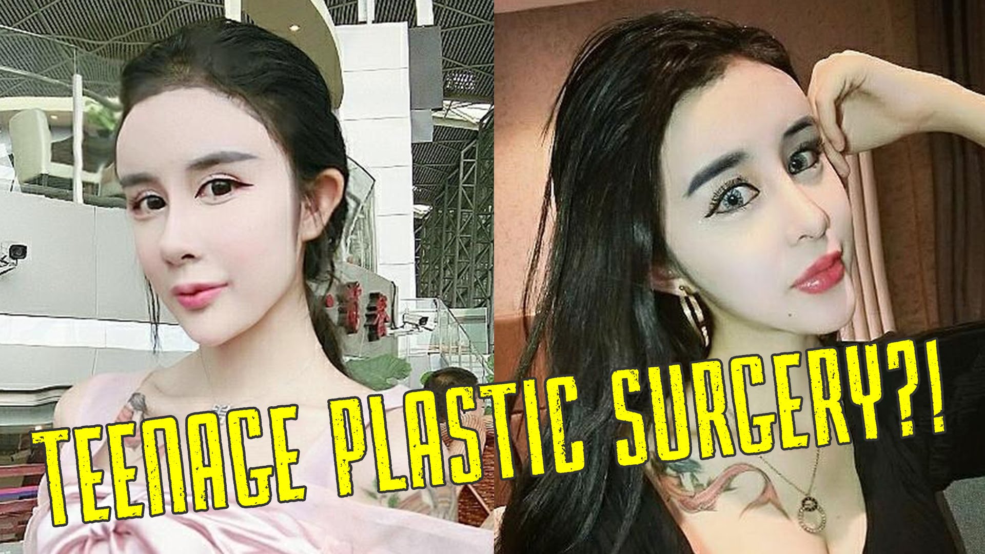 15 Yr Old Girl Gets Plastic Surgery To Look Fake