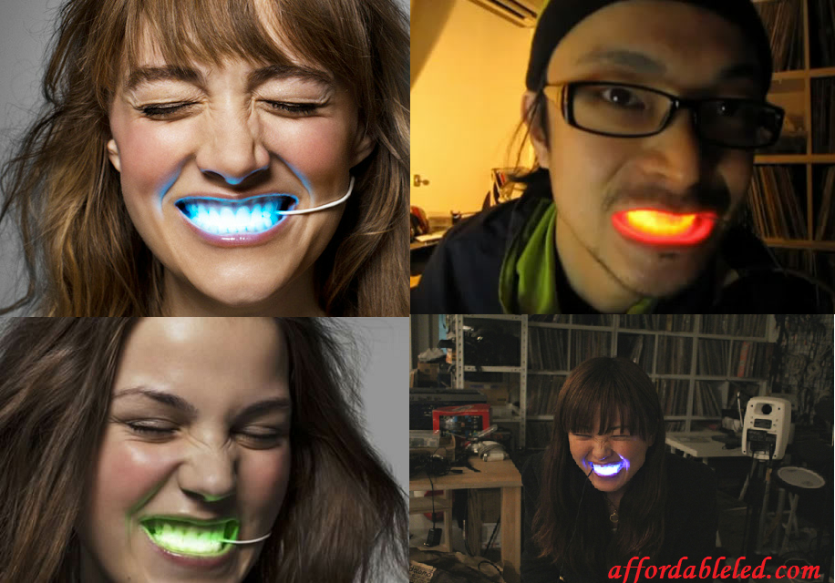 Now that the LED smiles are a hit, don’t be surprised when you see people flash a smile with a scrolling LED sign in their mouth.  With a LED smile, a LED sign smile is not far from happening.