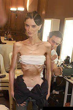 Holy Sh-- !Super-Skinny Fashion Models