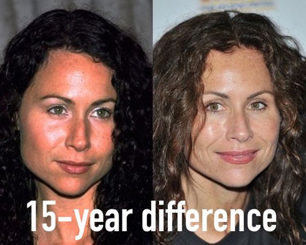 minnie driver botox - 15year difference