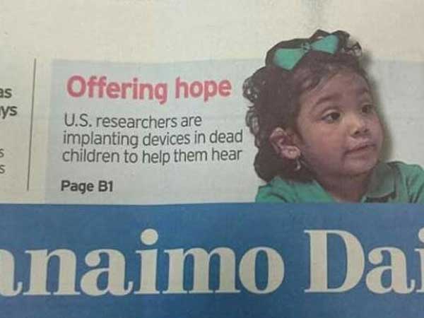 ys Offering hope U.S. researchers are implanting devices in dead children to help them hear Uu Page B1 anaimo Dai