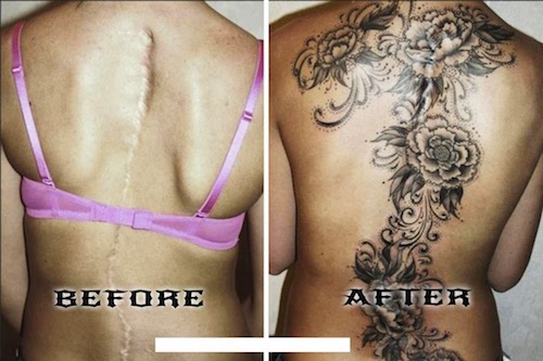 best tattoos cover scars - Before After