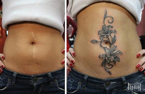 stomach scar tattoo cover up