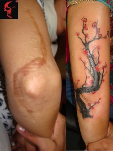 knee scar tattoo cover up