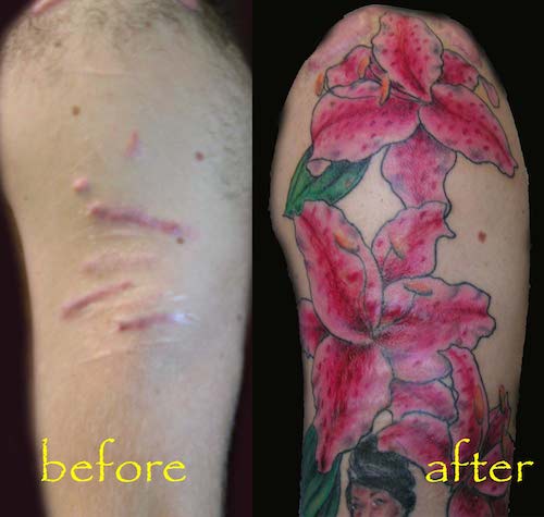 tattoo scar cover up - before after