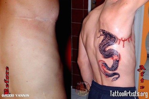 tattoos that incorporate scars