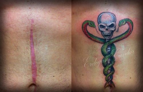 scar incorporate tattoo