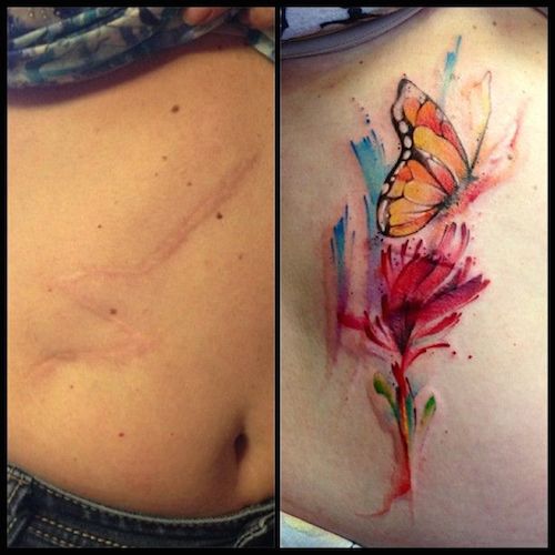 20 Incredible Tattoos That Cover Scars With Works Of Art