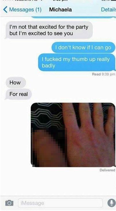Guy Tricks Girl Into Thinking He Had A Really Swollen Thumb