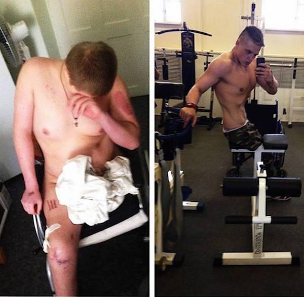 Disabled teen changes his lifestyle in the name of fitness