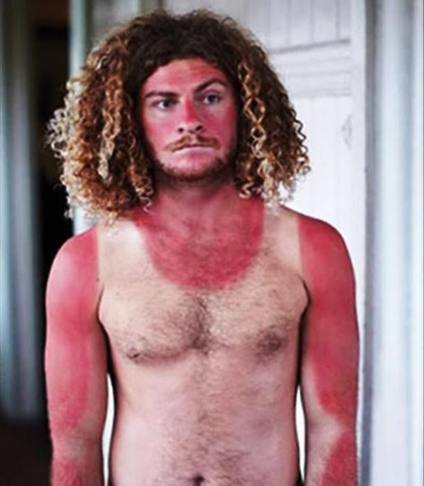 Insane Tanning Fails You Ll Be Glad You Avoided Gallery Ebaum S