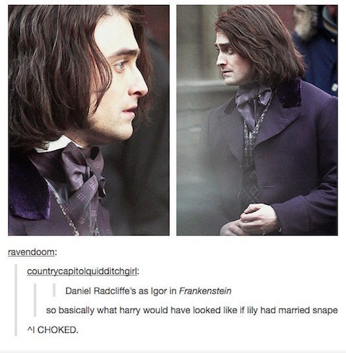 tumblr - daniel radcliffe igor - ravendoom countrycapitolquidditchgirl Daniel Radcliffe's as Igor in Frankenstein so basically what harry would have looked if lily had married snape A Choked.