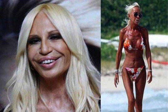 30 Horrifying Results of Terrible Plastic Surgery