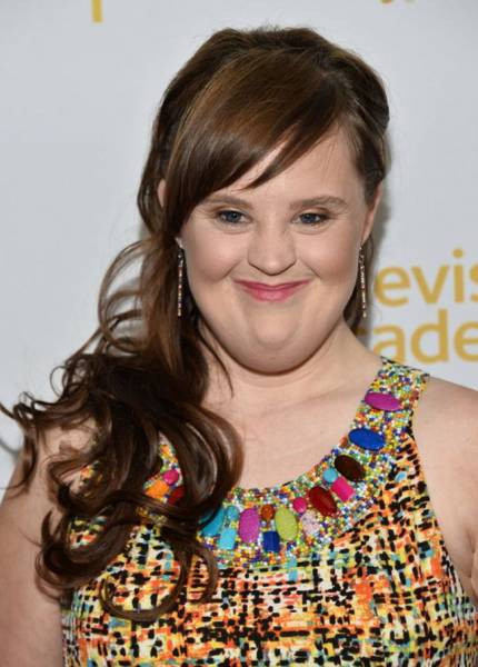 Jamie Brewer

She is the first world-known model with Down syndrome, and she has gained popularity as an actress in the TV series American Horror Story.