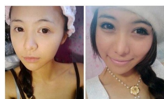 asian girls before after