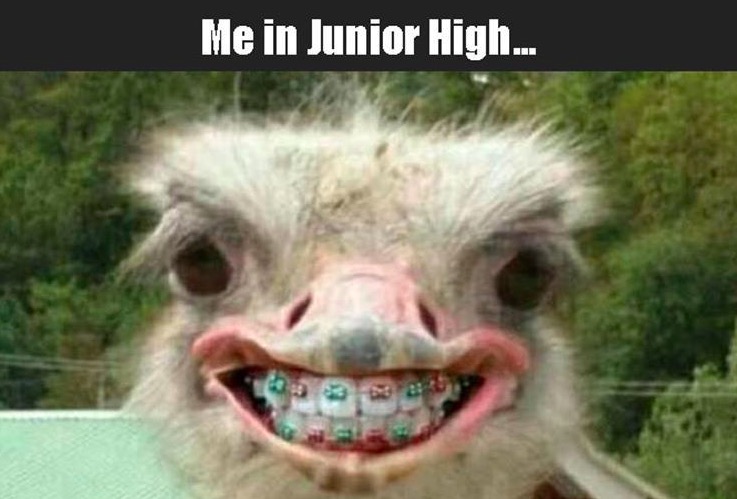 Meme about how in Junior high, everyone looks awkward and with braces.
