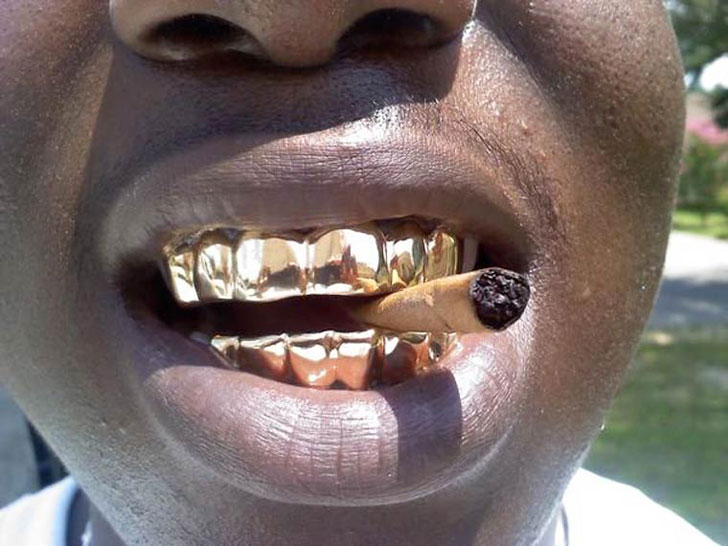 gold grille