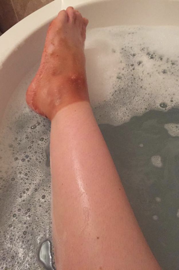 23 Spray Tan Fails That Will Make You Glad Tanning Isn't A Thing Anymore