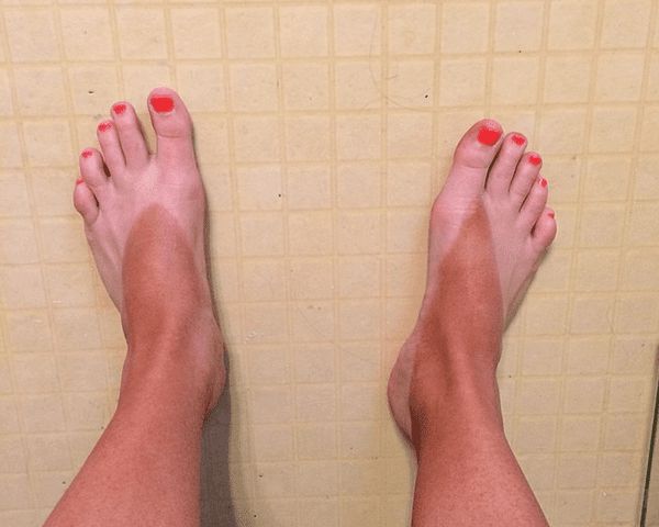 23 Spray Tan Fails That Will Make You Glad Tanning Isn't A Thing Anymore