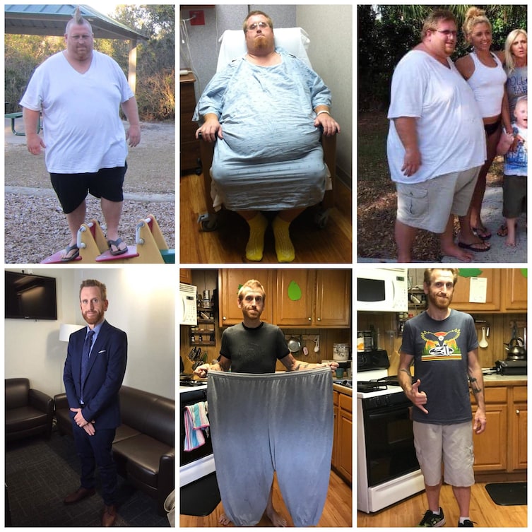If this guy can lose 350 pounds in less than 2 years, then anything is possible

He could wear one leg of his old sweatpants like a Snuggie, and that's incredibly impressive.