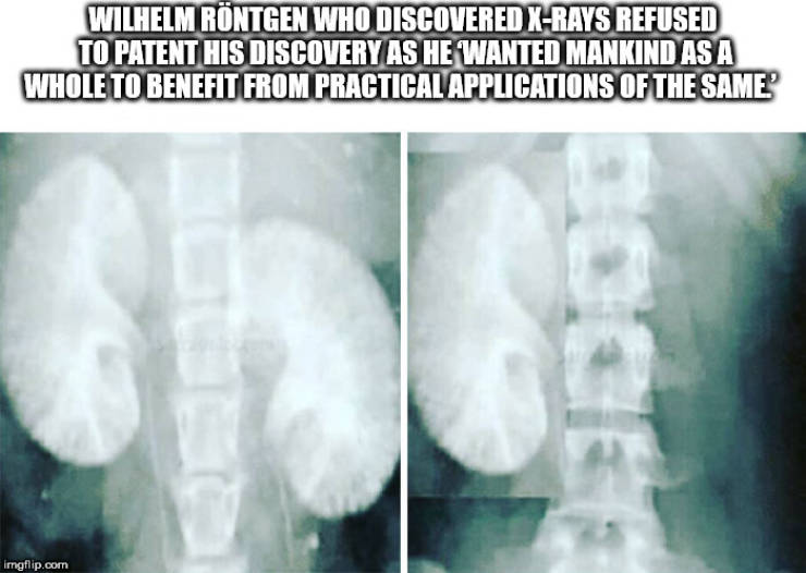 medical imaging - Wilhelm Rntgen Who Discovered XRays Refused To Patent His Discovery As He Wanted Mankind As A Whole To Benefit From Practical Applications Of The Same imgflip.com