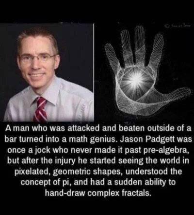quantum hand through my eyes - A man who was attacked and beaten outside of a bar turned into a math genius. Jason Padgett was once a jock who never made it past prealgebra, but after the injury he started seeing the world in pixelated, geometric shapes, 