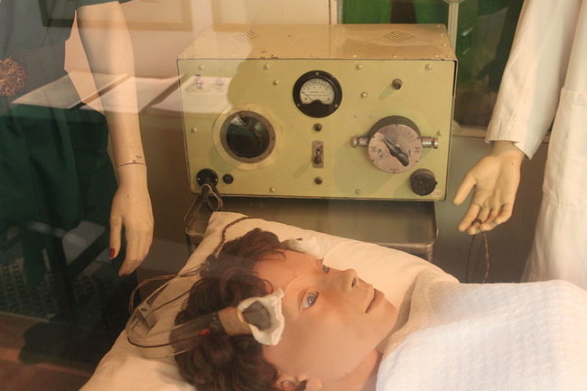 Electroconvulsive Therapy:
Also known as electroshock therapy, this therapy saw patients restrained and then hit with surges of electricity, which was thought to cure a variety of mental illnesses. It's still used today, but very rarely and in very specific circumstances. It's known to cause some memory loss.